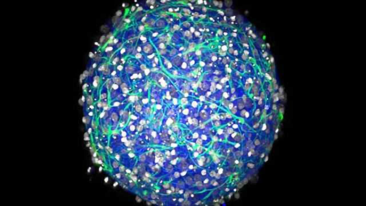 An accessible approach to making a mini-brain