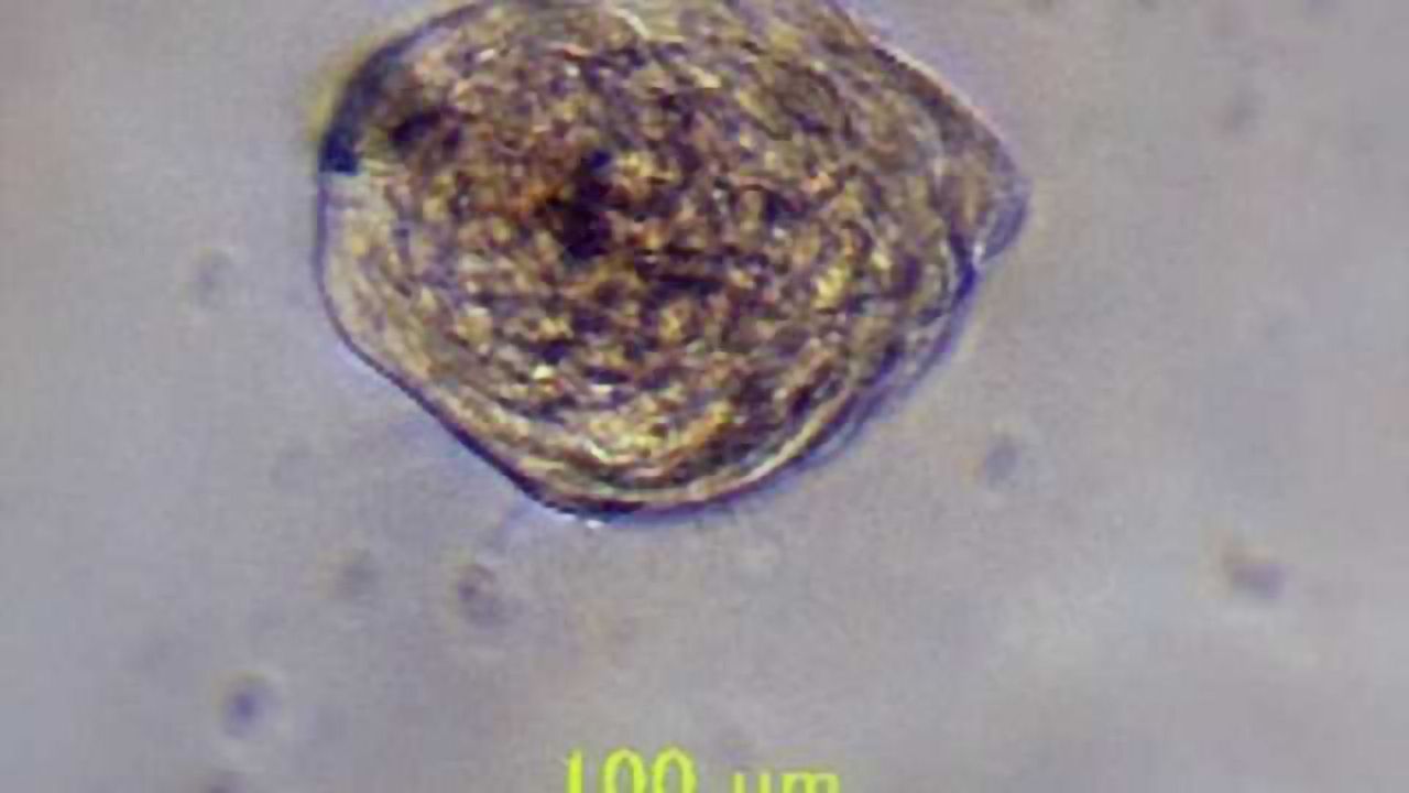 Transplantation of unique, newly discovered stems cells may lead to promising stroke therapy