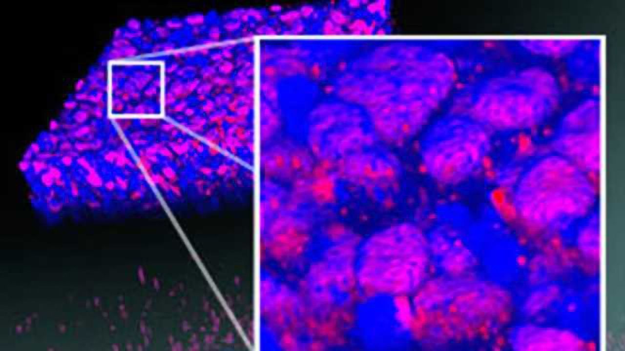 Restoring vision with stem cells