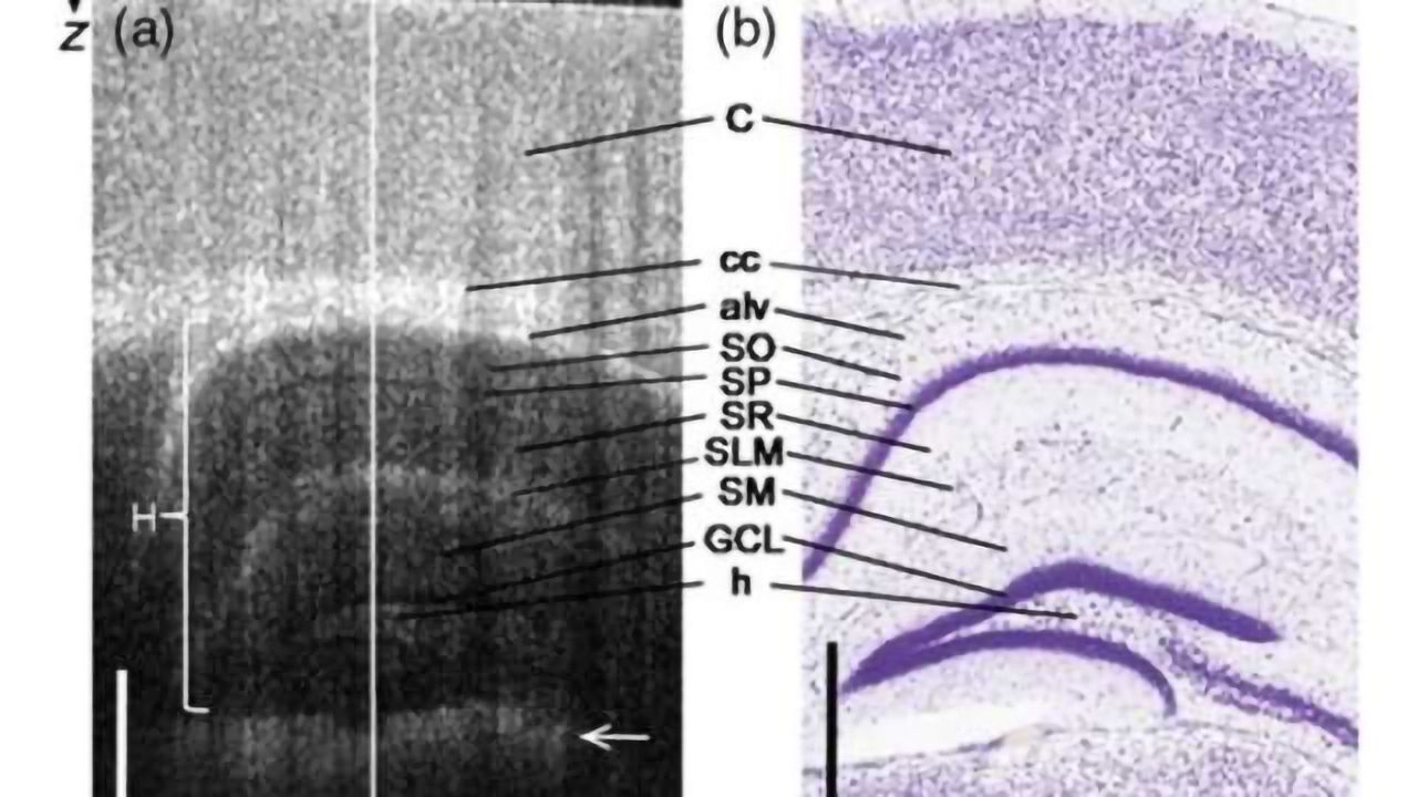 Noninvasive imaging method looks deeper inside the body to study living brain