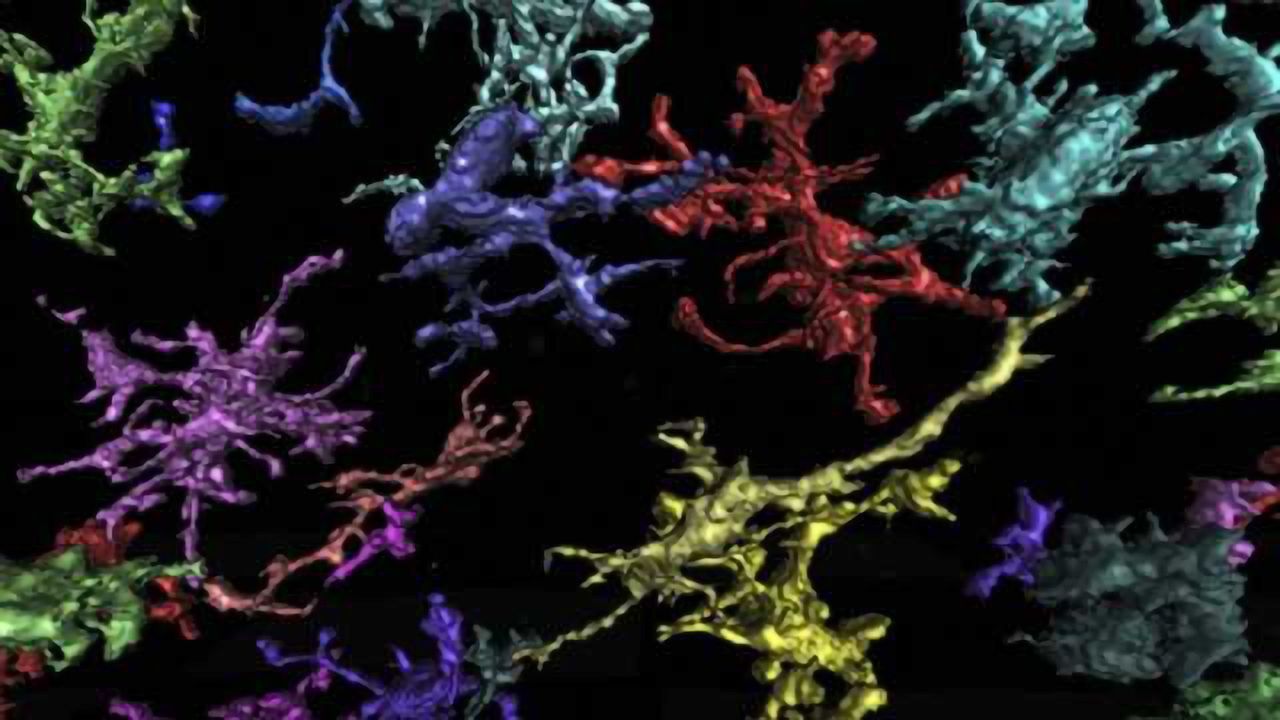 New depression diagnosis and treatment