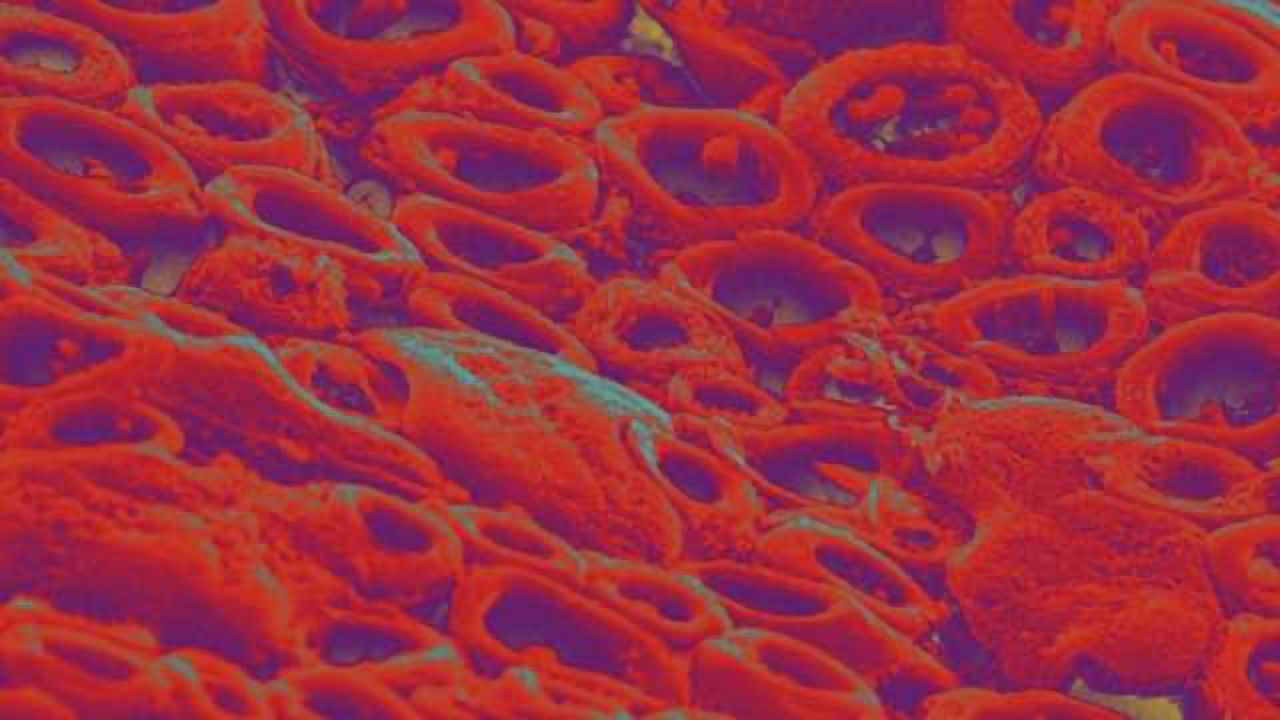New hope for the treatment of multiple sclerosis