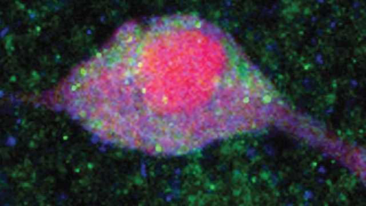New role for insulin: Studies tie the hormone to brain's "pleasure" center