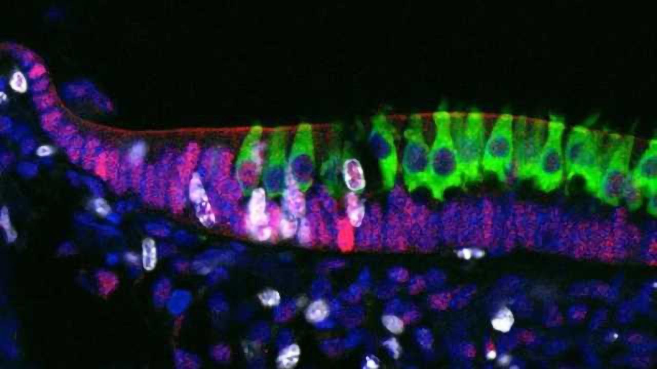 Discovery of genes involved in inner ear development hints at a way to restore hearing and balance