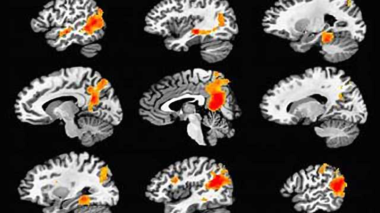 Study reveals brain mechanism for creating durable memories
