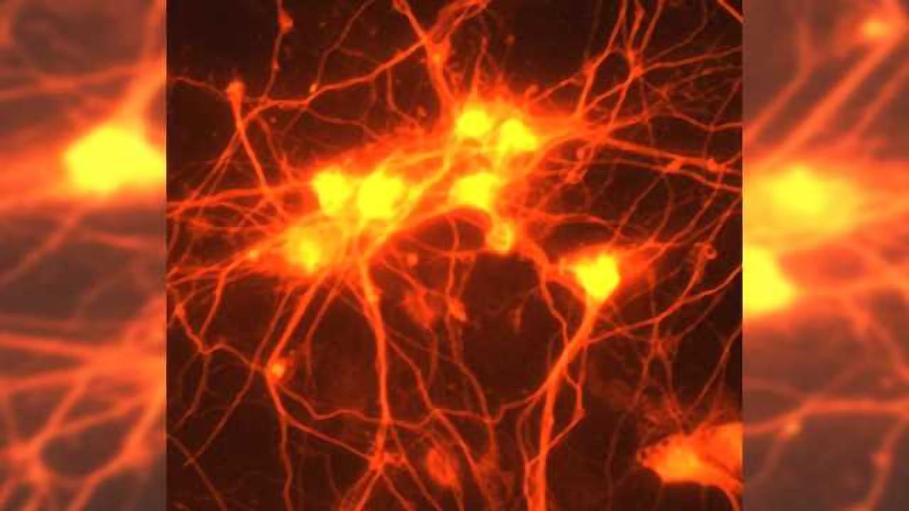 Main component of brain repair after stroke identified
