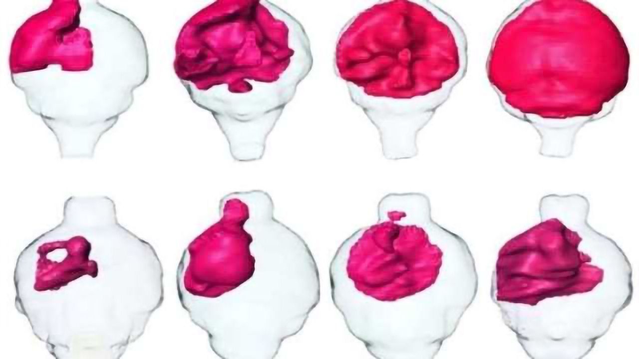New computational strategy finds brain tumor-shrinking molecules