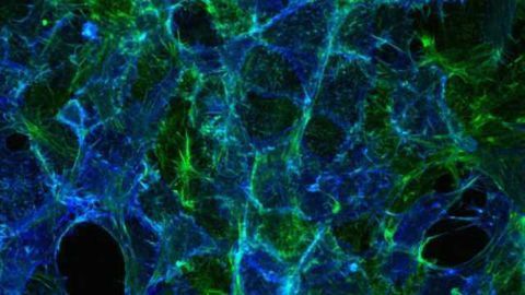 Diverse subtypes of serotonin-producing neurons uncovered
