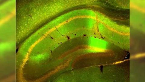 Protein repairs nerve cell damage: Novel gene therapy approach to treat Alzheimer’s