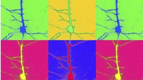 Researchers open “Golden Window” in deep brain imaging