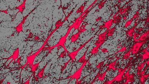 Batten disease may benefit from gene therapy