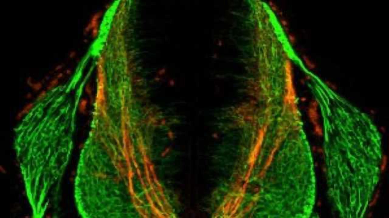 A newly discovered signaling molecule helps neurons find their way in the developing brain