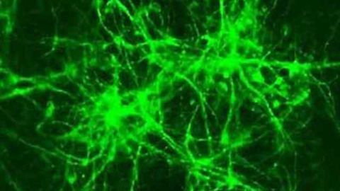 Bacterial protein can help convert stem cells into neurons