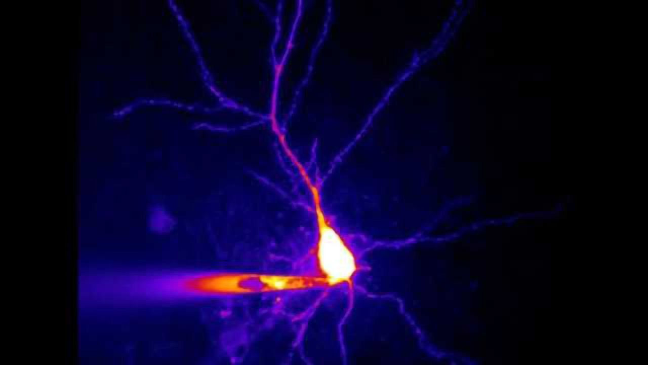 When the neuron's doorman allows too much in