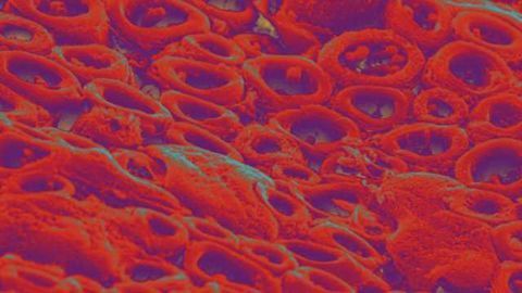 Immune-disorder treatment in mice holds potential for multiple sclerosis patients
