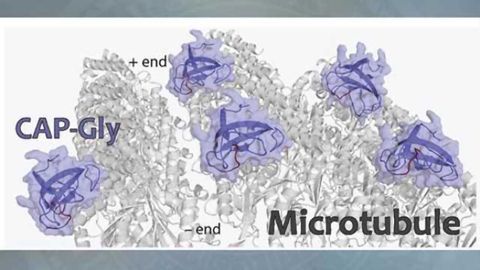 Peering into cell structures where neurodiseases emerge