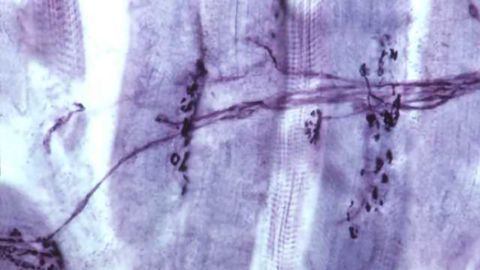 Scientists unexpectedly find ALS affects sensory neurons involved in movement