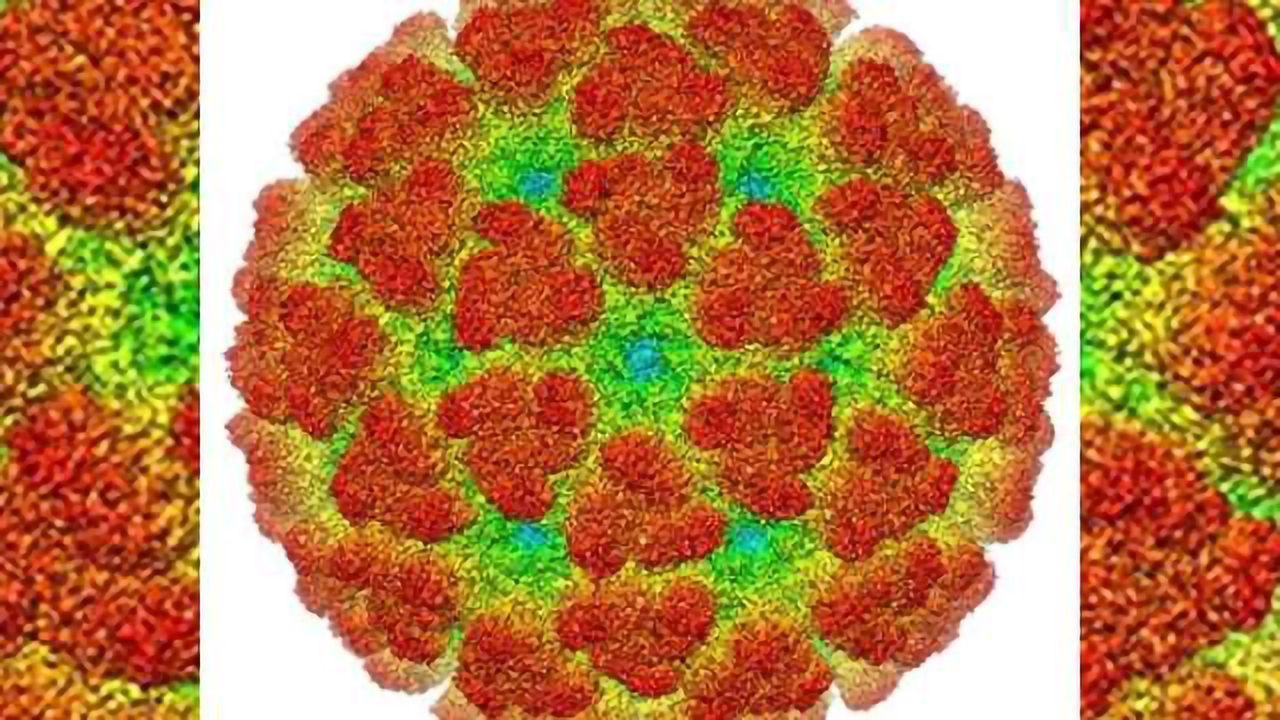 Mosquito-borne virus may lead to severe brain infection