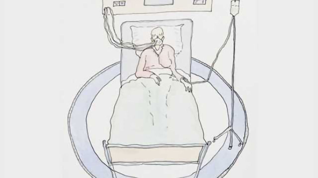 Neurotoxic effects of chemotherapies on cognition in breast cancer survivors