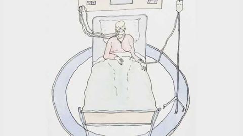 Neurotoxic effects of chemotherapies on cognition in breast cancer survivors