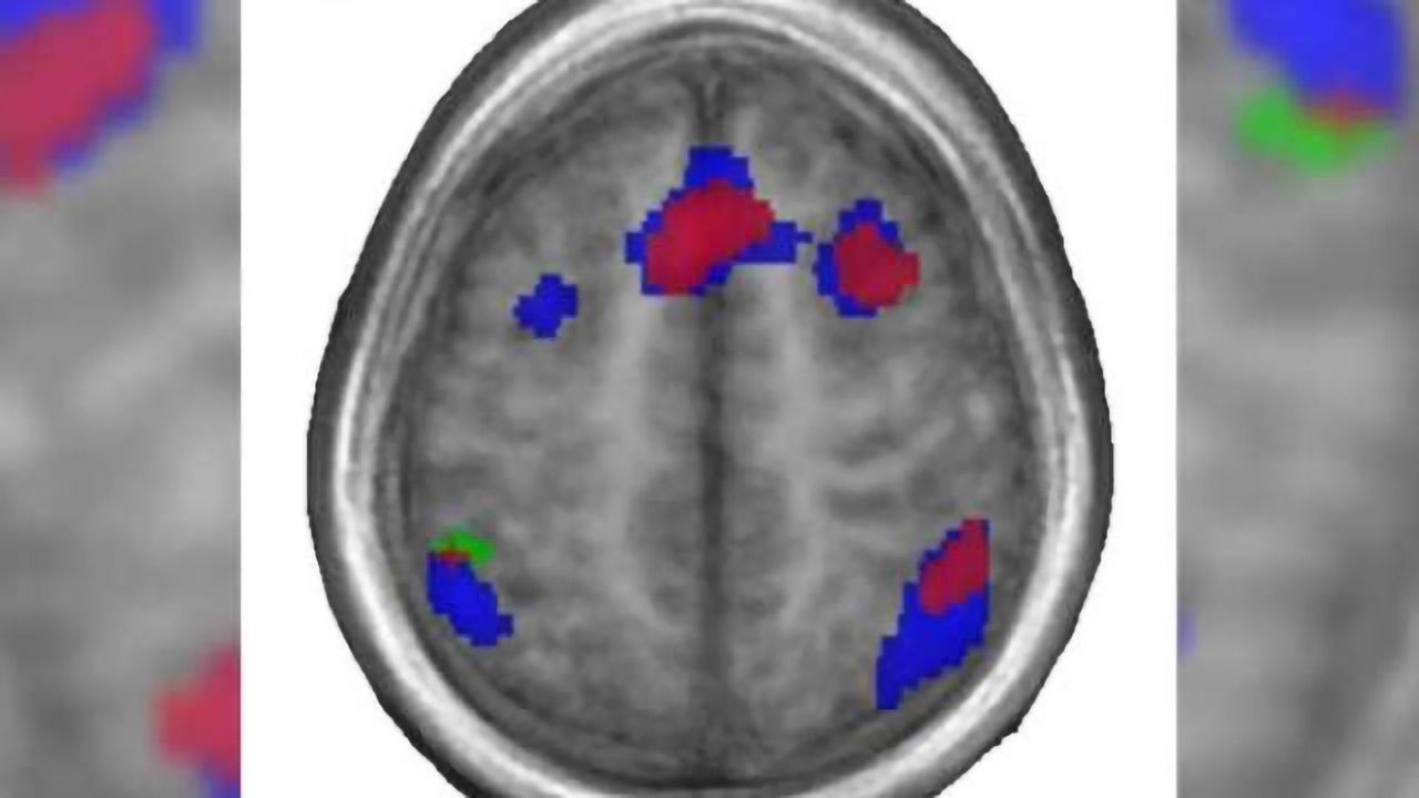 First language wires brain for later language-learning