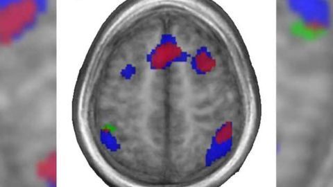 First language wires brain for later language-learning