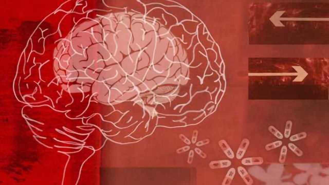 Depressed head and neck cancer patients three-and-one-half times less likely to survive, have higher recurrence risk