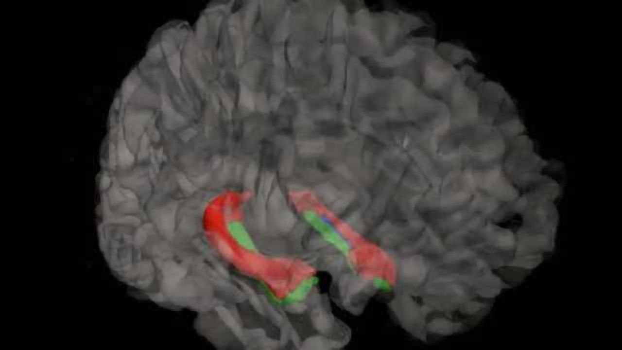 Micro-map of hippocampus lends big hand to brain research