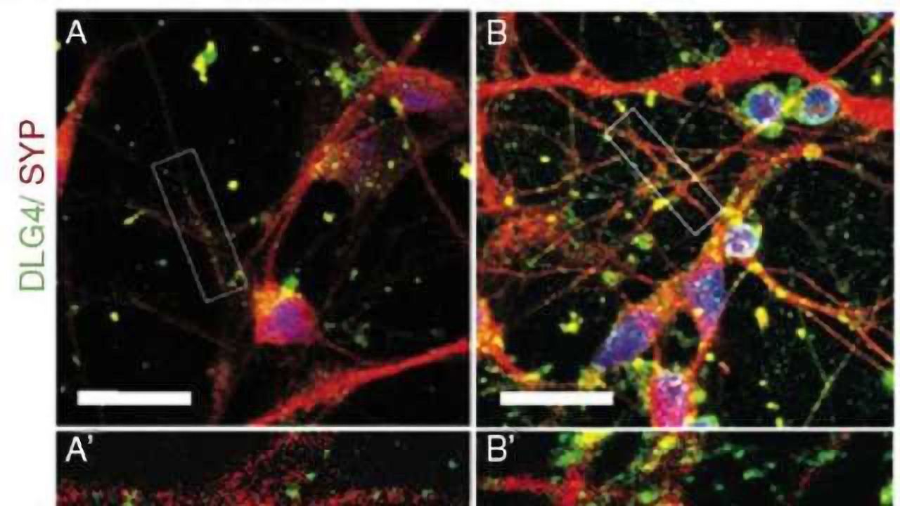 Plant compound found in spices and herbs increases brain connections