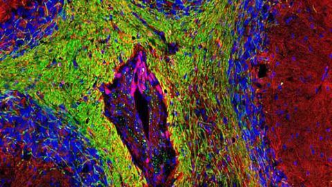 Brain cell death is a possible trigger of multiple sclerosis