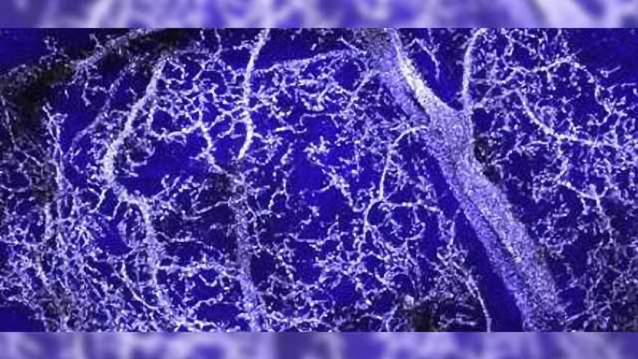 Novel imaging technique captures beauty of metal-labeled neurons in 3-D