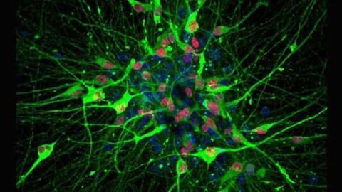 First serotonin neurons made from human stem cells