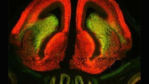 Widespread skewed expression of mRNA components correlate with fine tuning of protein production