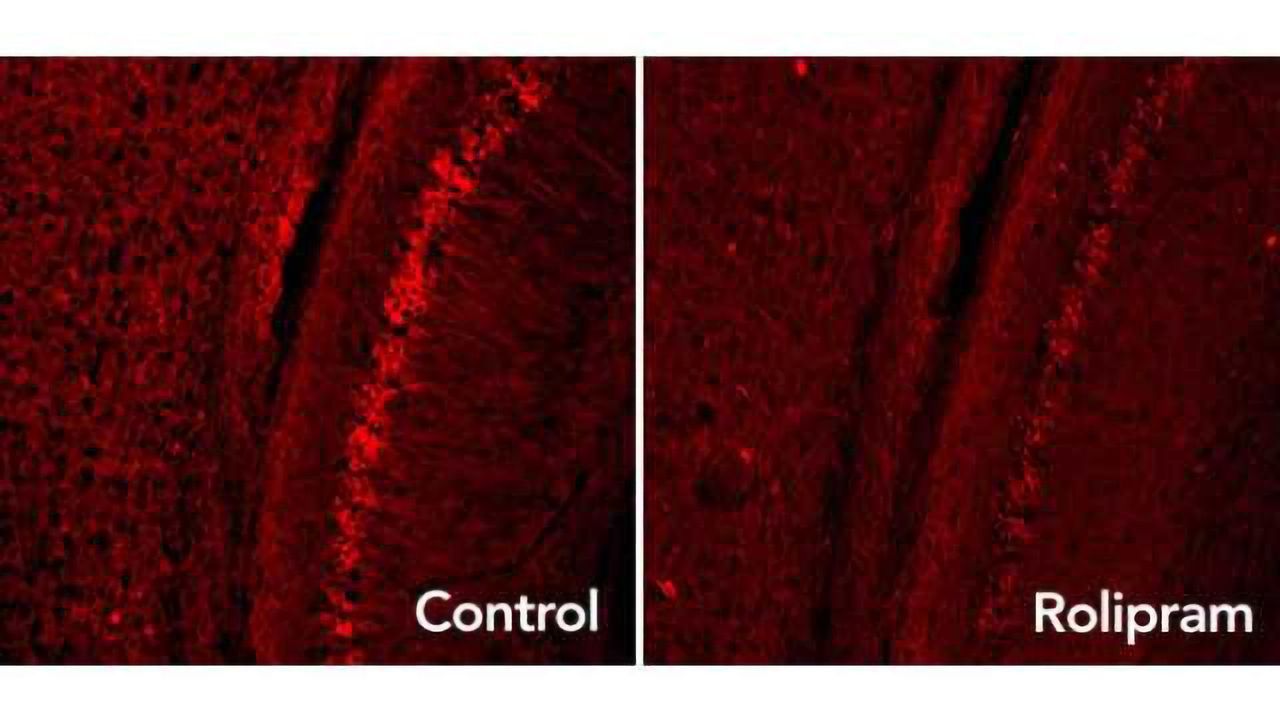 Improving brain's garbage disposal may slow Alzheimer's and other neurodegenerative diseases