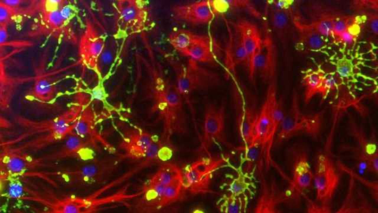 Not enough YAP means too much deadly inflammation inside the brain