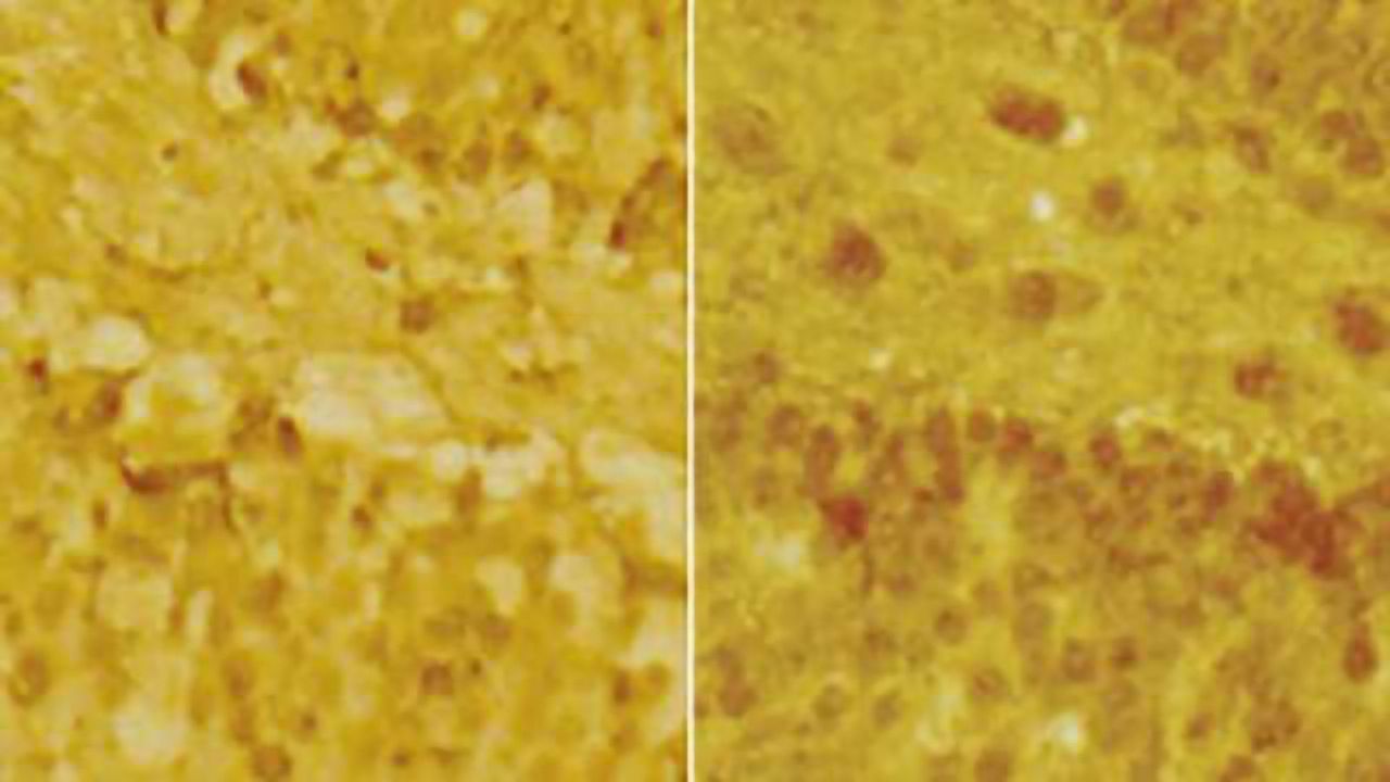 Newly discovered windows of brain plasticity may help with treatment of stress-related disorders