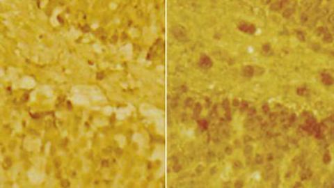 Newly discovered windows of brain plasticity may help with treatment of stress-related disorders