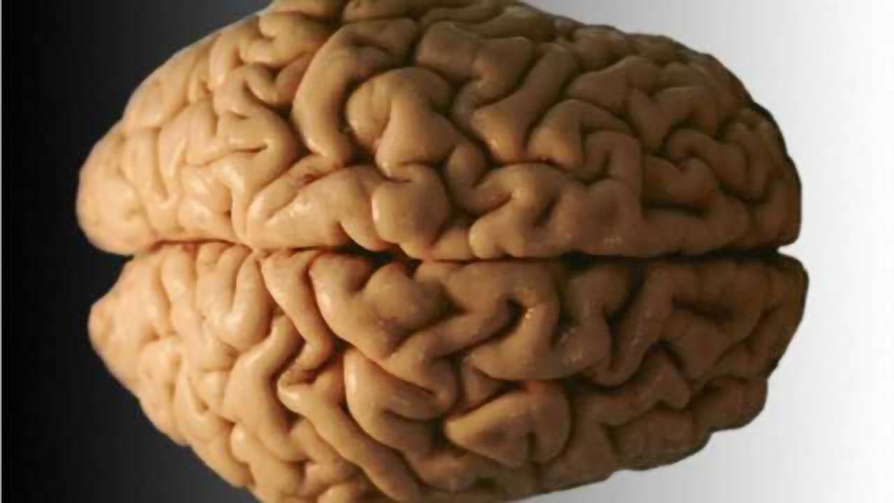 Two Alzheimer's risk genes linked to brain atrophy, promise future blood markers