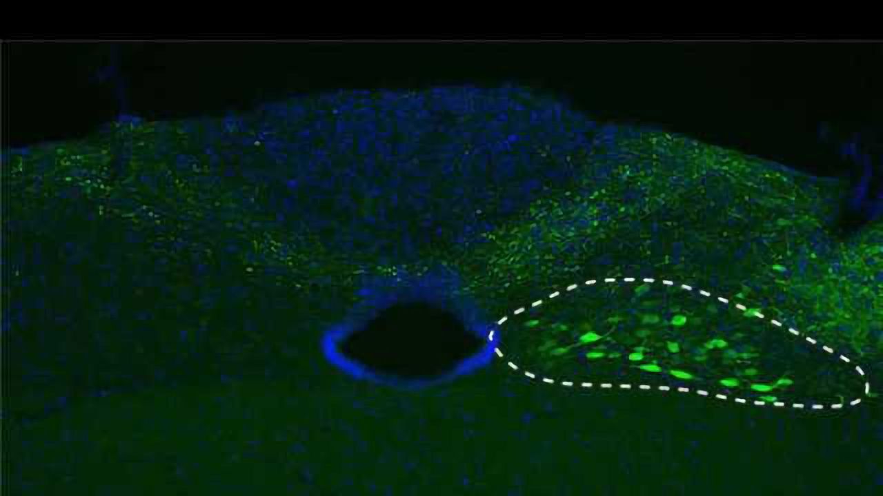 Parkinson’s disease: New insights into a traveling protein