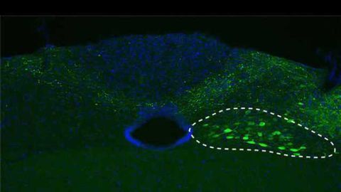 Parkinson’s disease: New insights into a traveling protein