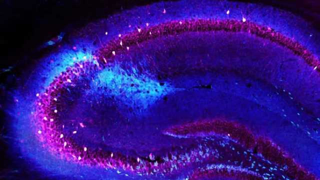 Loss of cells in brain's memory center linked to schizophrenia