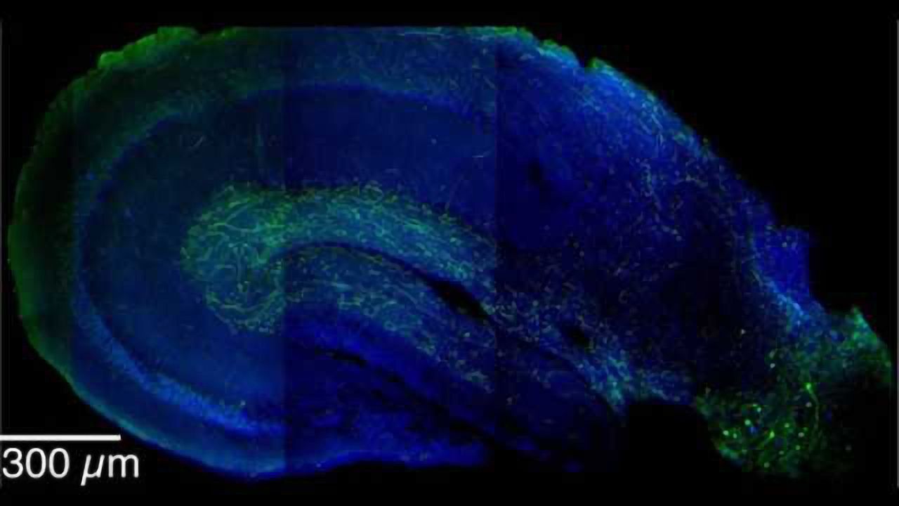 Cellular ‘switch’ helps brain distinguish safety from danger, new study finds