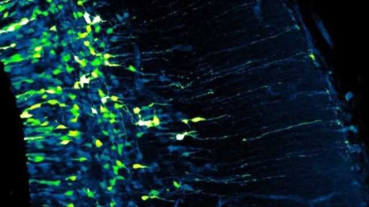 Slow stem cell division may cause small brains