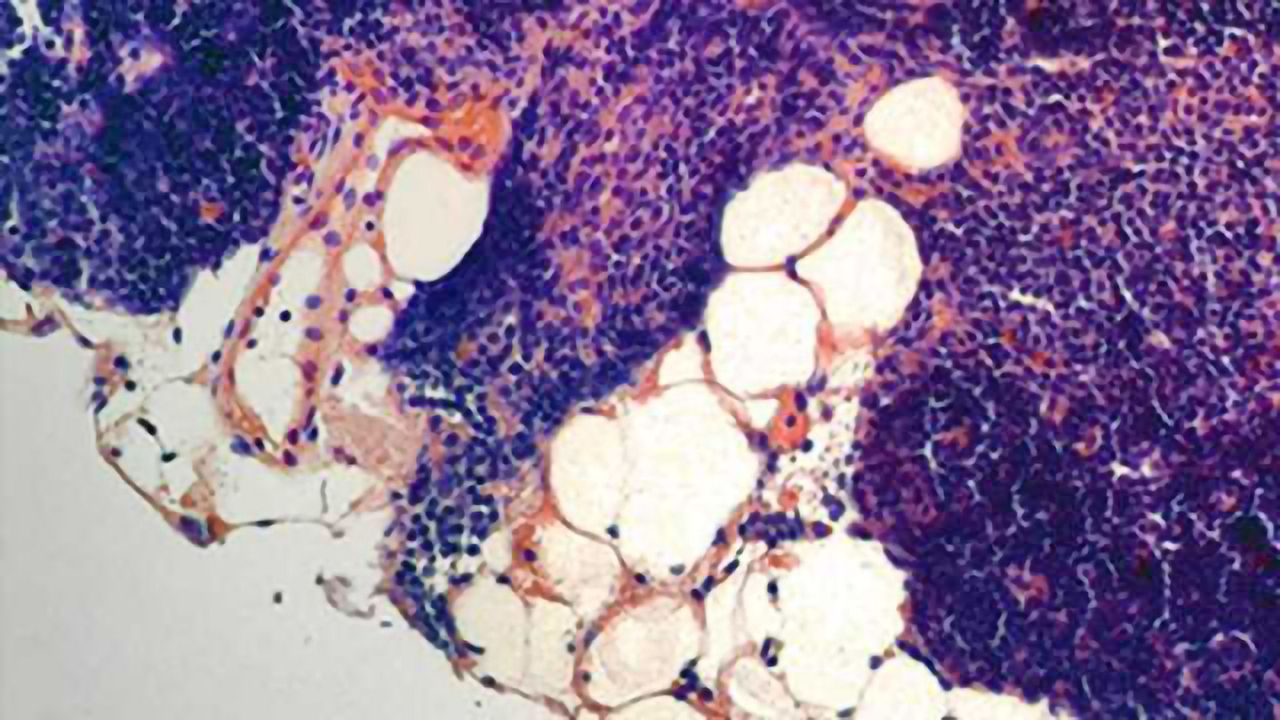 Life-extending hormone bolsters the body’s immune function