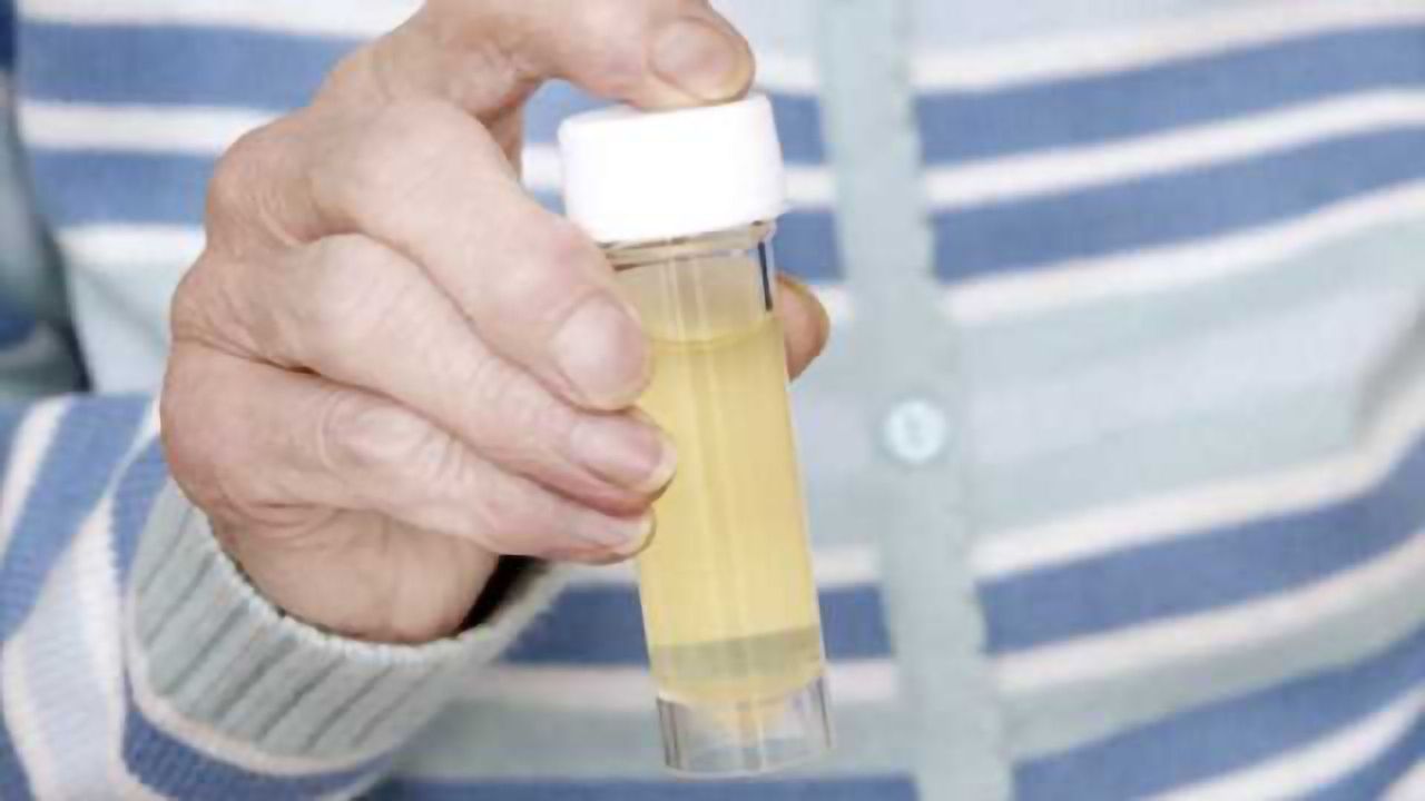 Odor biomarker for Alzheimer’s disease
