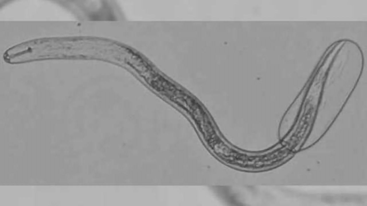 Closer look reveals nematode nervous systems differ