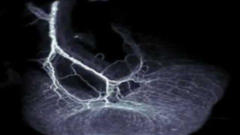 The neurons in our gut help the immune system keep inflammation in check
