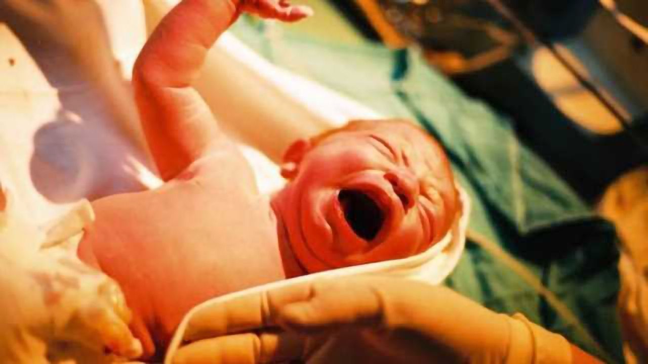 Most cases of brain-damaged newborns not due to mismanaged deliveries