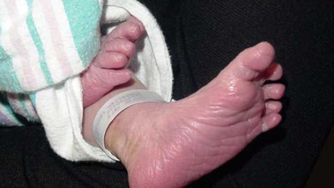Study finds four factors predict neurodevelopmental outcomes for children with low birth weight
