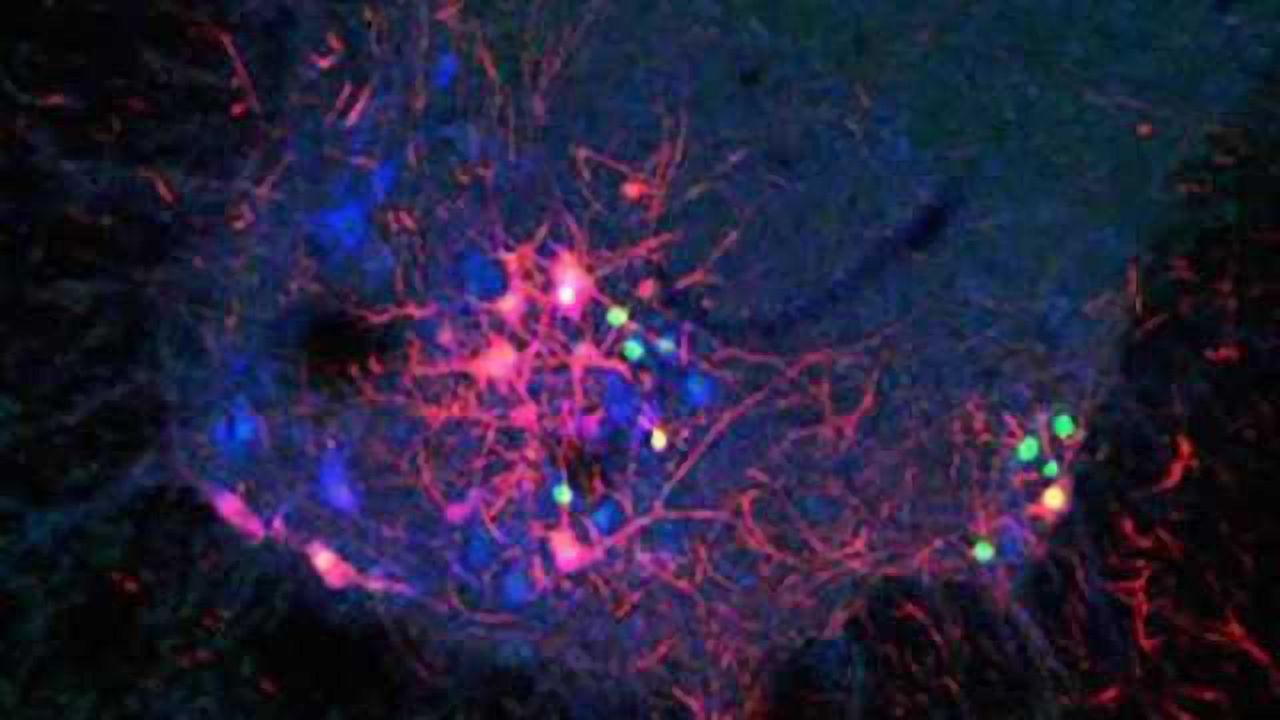 New viral tools to safely trace brain circuits developed